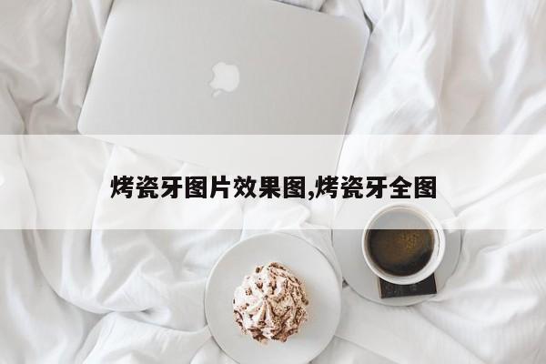 烤瓷牙图片效果图,烤瓷牙全图